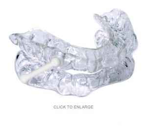 Silent Nite anti snoring