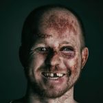 dentist-emergencies-f