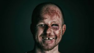 dentist-emergencies-f