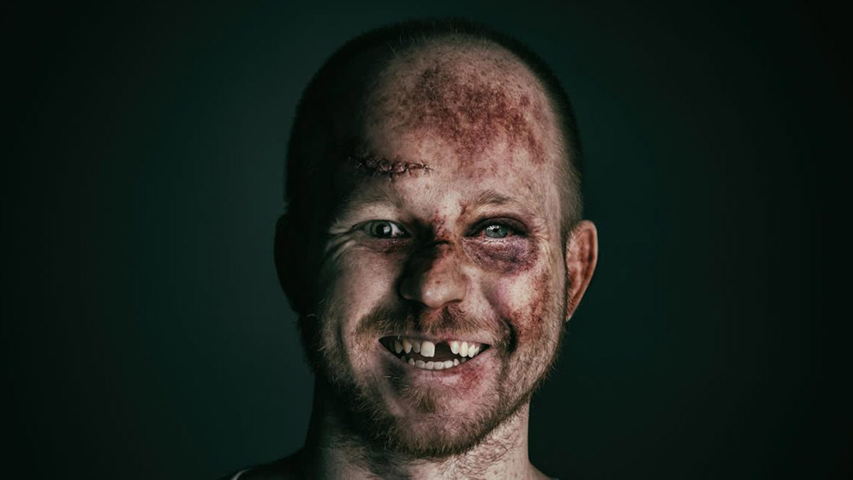 dentist-emergencies-f