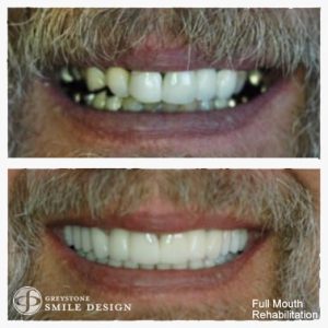 cosmetic-dentist-patient-case-photo-14