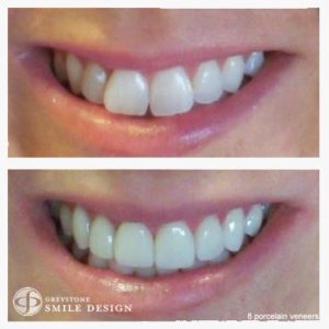 cosmetic-dentist-patient-case-photo-713
