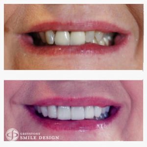 cosmetic-dentist-patient-case-photo-12