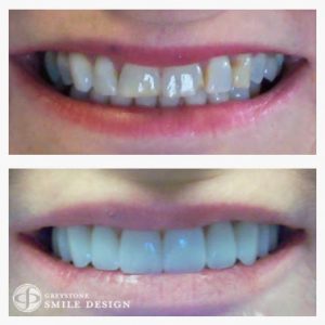 cosmetic-dentist-patient-case-photo-3-1